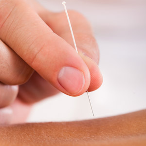 Conditions Treated with Chinese Medicine